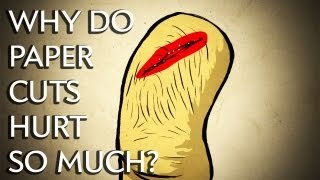 Why Do Paper Cuts Hurt So Much  Instant Egghead 25 [upl. by Oby]