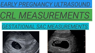 Pregnancy ultrasound showing CRL GESTATIONAL SAC MEASUREMENTS Early Pregnancy ultrasoundyoutube [upl. by Adianez]