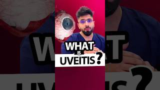 What is Uveitis [upl. by Ahk]