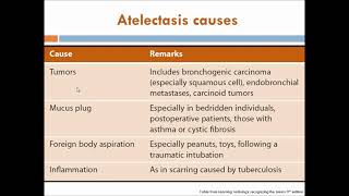 Lecture 5  Opacified hemithorax atelectasis and pleural effusion [upl. by Pepin488]