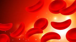 Sickle Cell Anemia [upl. by Tera]