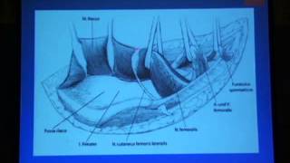 15 Ilioinguinal approach Rommens [upl. by Alana]