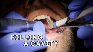 How Does A Dentist Fill A Cavity [upl. by Hannah574]