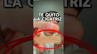 TE QUITO LA CICATRIZ asmr shorts asmrvideo comedia [upl. by Briggs48]