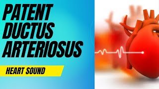 Patent Ductus Arteriosus Patent Ductus Arteriosus Murmur Sound Heart Sound [upl. by Ylim]