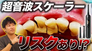 【歯石除去】家庭用超音波口腔スケーラーで自分で歯石取りはできる？自分で歯石が取れるのは危険！？【歯石】 [upl. by Brause]