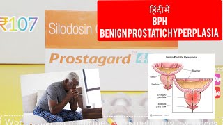 Prostagard silodosin tablet uses in Hindi BPH का ट्रीटमेंट [upl. by Odracer]