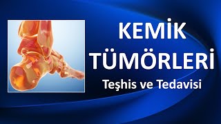 KEMİK TÜMÖRLERİ TEŞHİS VE TEDAVİSİ [upl. by Taylor205]