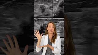 What Does Breast Cancer Look Like on an Ultrasound [upl. by Alemrac]