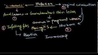 Listeria monocytogenes infection [upl. by Maxfield778]