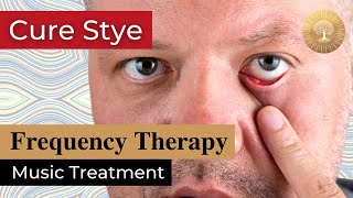 Heal Stye Eye Music Therapy ๏ Rife Frequency Bioresonance Treatment ๏ Healing Nature Frequencies [upl. by Atterbury]