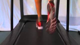 Flatfeet advice for runners [upl. by Rotciv]