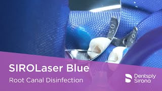 SIROLaser Blue  Root Canal Disinfection [upl. by Alegnasor]