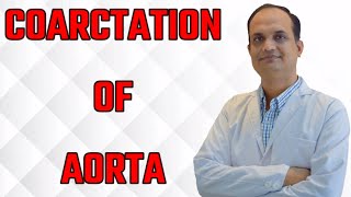 coarctation of aorta collaterals [upl. by Olemrac925]