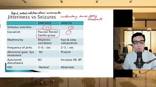 How to differentiate between Neonatal Jitteriness and Neonatal Seizures [upl. by Krever551]