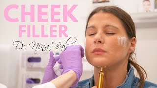 Cheek Filler Technique with Cannula I Breakdown [upl. by Delgado]