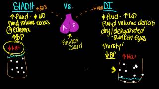 SIADH vs DI [upl. by Martguerita16]