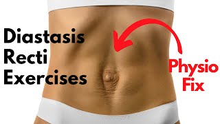 How to START Diastasis Recti Exercises that FIX YOUR GAP  PHYSIO GUIDED Abdo Separation Repair [upl. by Olegna]