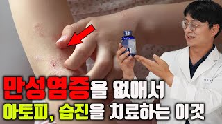 만병의 근원 만성염증을 없애서 아토피 습진 등의 피부염을 낫게 하는 이것 염증 조절 면역균형 개선 항산화 영양제 [upl. by Draper]