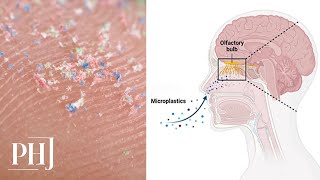 Microplastics Detected in Human Brain Raises New Health Concerns [upl. by Westfall164]