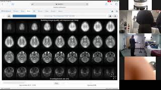 DEMO Hyperfine Bedside MRI [upl. by Finegan]