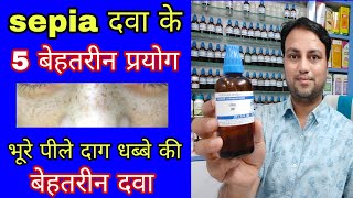 Sepia 30 के 5 क्लिनिकल उपयोग sepia 30 best homeopathic medicine for menses problems jhaai ki dava [upl. by Nnaeirrac]