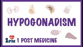 Hypogonadism [upl. by Aidul]