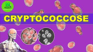 CRYPTOCOCCOSE  cours de mycologie médicale [upl. by Eidak816]