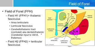 Neurosurgery written board crash course  basal ganglia part 2 [upl. by Huldah3]