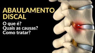 Abaulamento Discal  O que é Quais os sintomas Como tratar [upl. by Yoshi]