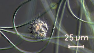 Acanthamoeba sp an opportunistic pathogen [upl. by Seed]