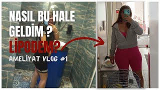 Lipödem nedir Nasıl fark ettim Tedavisi nedir lipödem ameliyat doctor vlog [upl. by Annabela577]