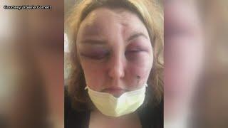 Woman shares domestic violence story in hopes of helping others [upl. by Htepsle]