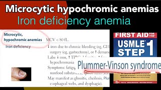 Microcytic hypochromic anemias Iron deficiency anemia PlummerVinson syndrome in HindiUrdu USMLE [upl. by Eneleuqcaj]