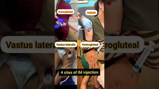 Intramuscular injection kaise lagate hai shorts [upl. by Htenaj836]