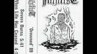 Nihilist Severe Burns Rare Drowned Demo 89 [upl. by Turner]