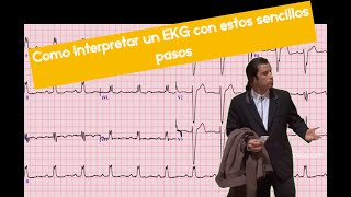 Como interpretar un electrocardiograma normal [upl. by Oicnerual]