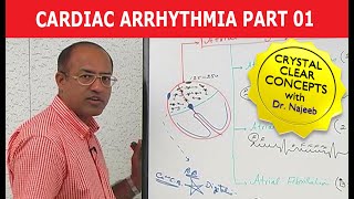 Cardiac Arrhythmia  Part 13 [upl. by Cornelle]