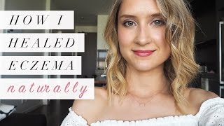 How I Healed Eczema Naturally  My Story [upl. by Christmas]