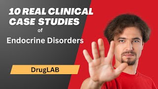 Endocrine Disorders 10 Real Clinical Case Studies  DrugLab [upl. by Esiom]