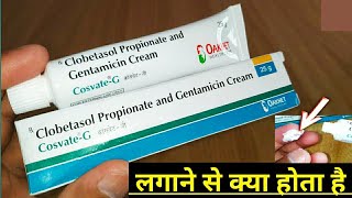 Cosvate G Cream Uses In Hindi  Clobetasol Propionate And Gentamicin Cream  कॉसवेट जी क्रीम [upl. by Galvin804]