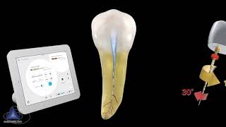 WaveOne® Gold Glider with Dr Cliff Ruddle  Dentsply Sirona [upl. by Notlok]