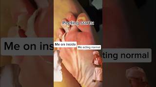 Insane Foot Peel Mask  Crazy Peeling in 5 Days  Baby Soft Feet Transformation Smooth Skin shorts [upl. by Aikenahs]