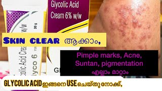 How to use glycolic Acid creamGlyco 6ww Review in malayalam [upl. by Mateusz786]