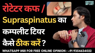 रोटेटर कफ का कम्पलीट टियर कैसे ठीक करें  Best Treatment for Complete Rotator Cuff Tear [upl. by Jacinda403]