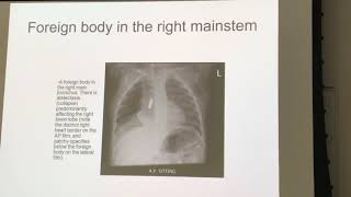 CXR and Abdomen radiographic positioning [upl. by Deste]