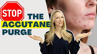 Accutane Acne Purge Do THIS [upl. by Atteynad656]