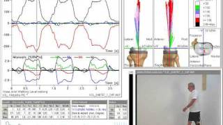 Loads Acting in the Knee Joint During Walking [upl. by Terr]