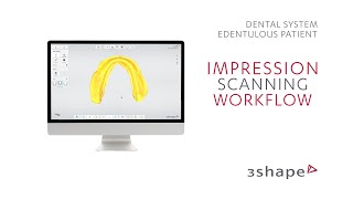 3Shape TRIOS Edentulous patient  Impression scanning workflow [upl. by Arimat665]