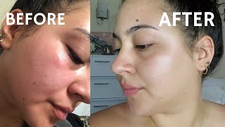 I followed SKINCARE BY HYRAMS product recommendations for 1 week Here are my RESULTS [upl. by Evatsug]